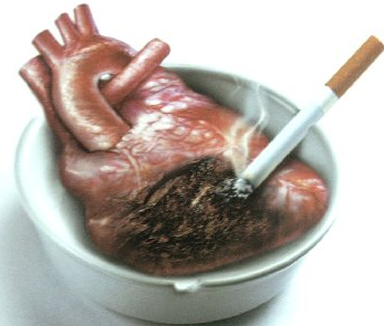 Infarctus chez la femme : le tabagisme est la principale cause